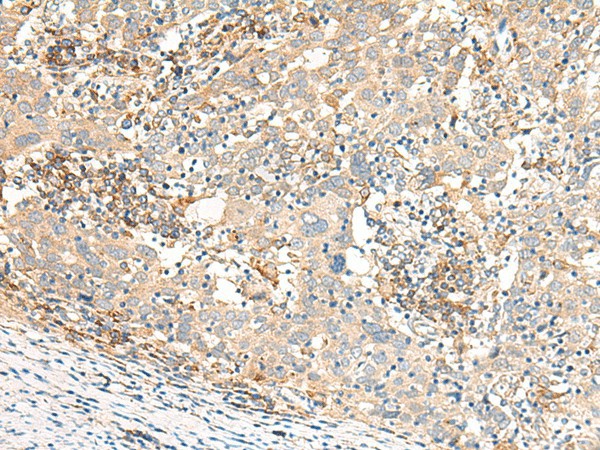 GBP4 Polyclonal Antibody (E-AB-17990)
