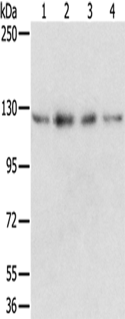 RBM5 Polyclonal Antibody (E-AB-11529)