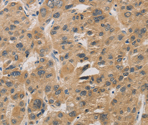 DDIT4 Polyclonal Antibody (E-AB-11148)