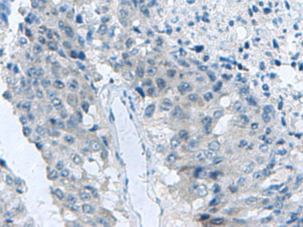 MED31 Polyclonal Antibody (E-AB-53034)