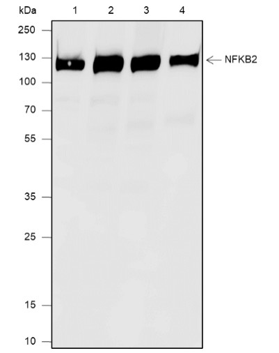 Recombinant NF-kB2 p100/p52 Monoclonal Antibody (AN301826L)