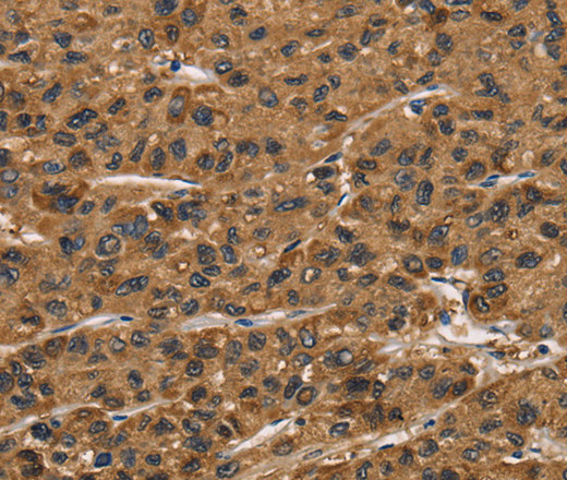 ATP7A Polyclonal Antibody (E-AB-16268)