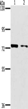 PPP1R13L Polyclonal Antibody (E-AB-15724)