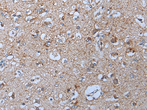 YPEL5 Polyclonal Antibody (E-AB-53545)