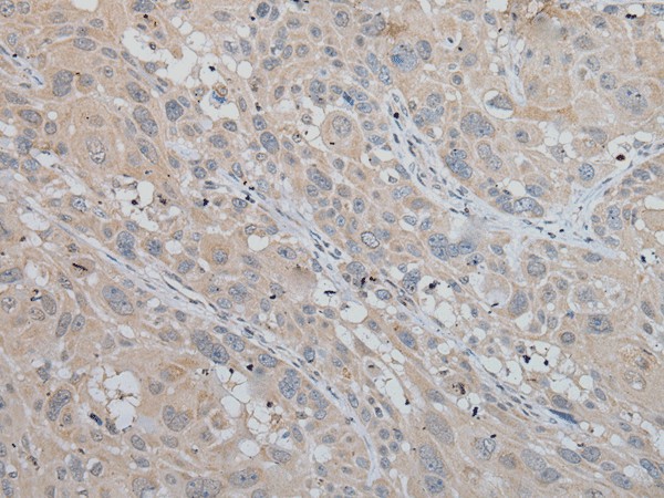 MLANA Polyclonal Antibody (E-AB-19522)