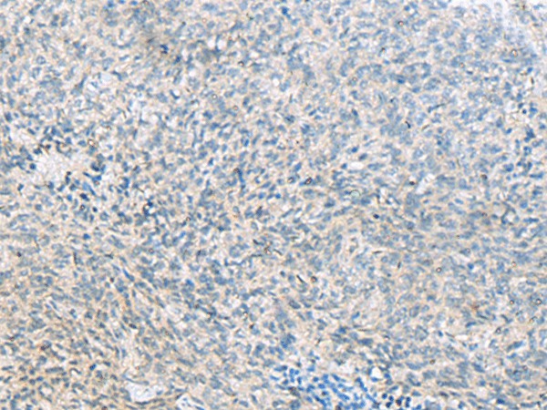 C1orf112 Polyclonal Antibody (E-AB-52494)