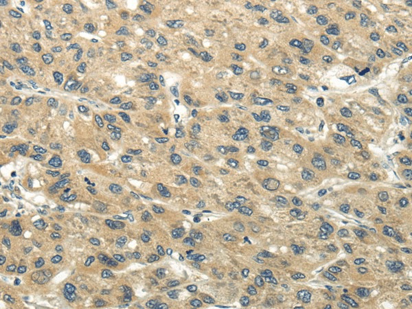 CHGB Polyclonal Antibody (E-AB-17302)