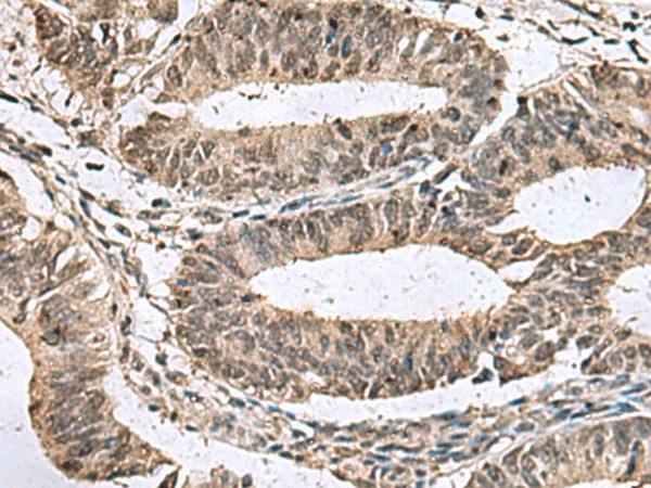 TMX3 Polyclonal Antibody (E-AB-19158)