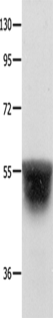 KCNA1 Polyclonal Antibody (E-AB-15740)