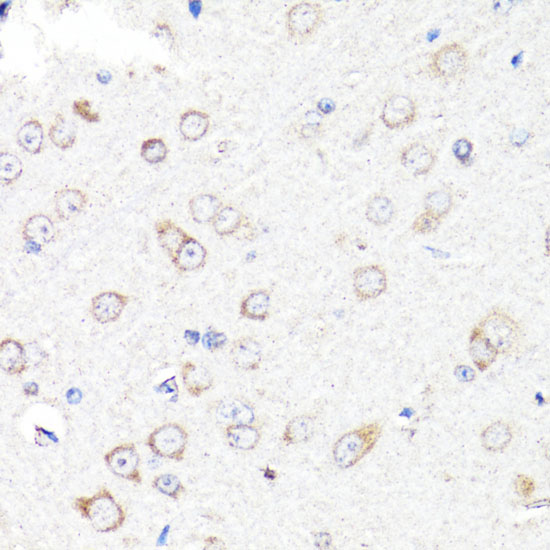 RNF149 Polyclonal Antibody (E-AB-66510)