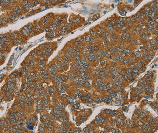 NPPB Polyclonal Antibody (E-AB-14708)