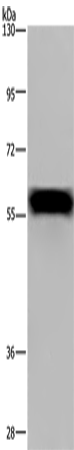 FGB Polyclonal Antibody (E-AB-15039)