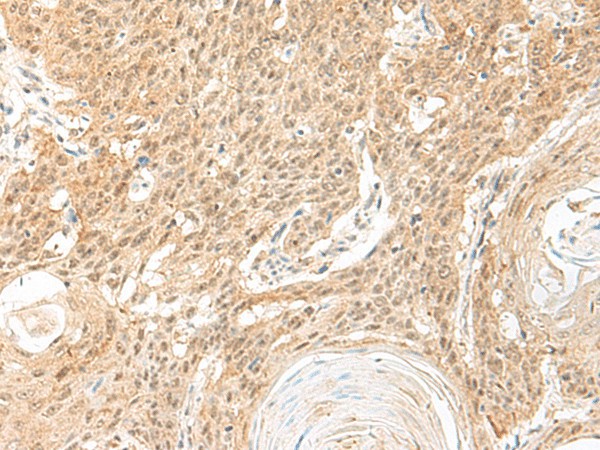 BICRA Polyclonal Antibody (E-AB-19913)
