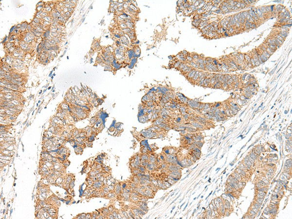 SLC6A9 Polyclonal Antibody (E-AB-18007)