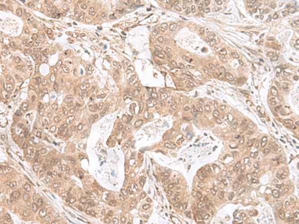 ETV3 Polyclonal Antibody (E-AB-17926)