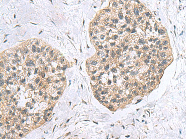 RPL18 Polyclonal Antibody (E-AB-53069)