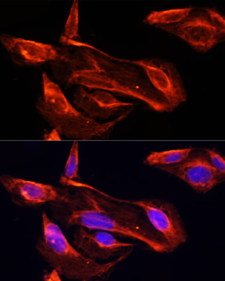 MMP2 Polyclonal Antibody (E-AB-65806)