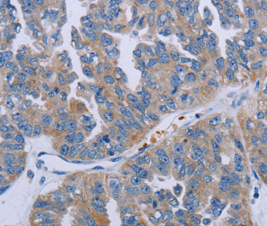 P2RY2 Polyclonal Antibody (E-AB-13480)