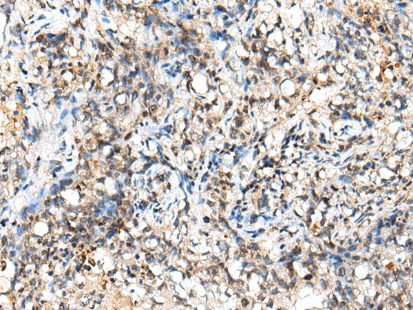 NUDT18 Polyclonal Antibody (E-AB-52306)