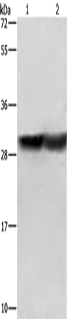 CALB1 Polyclonal Antibody (E-AB-14812)
