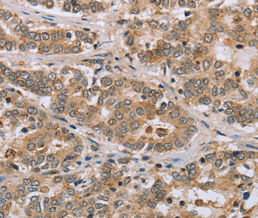 CLEC16A Polyclonal Antibody (E-AB-13458)