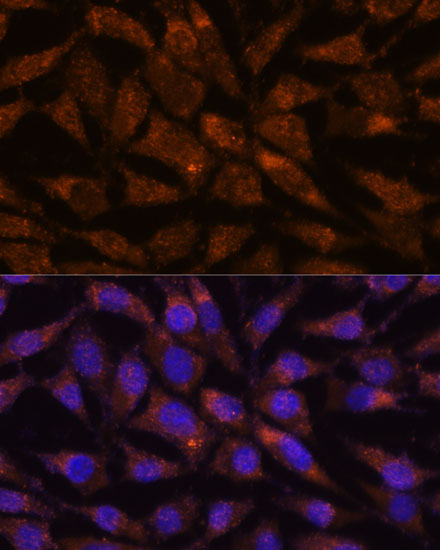 LMAN2 Polyclonal Antibody (E-AB-65300)