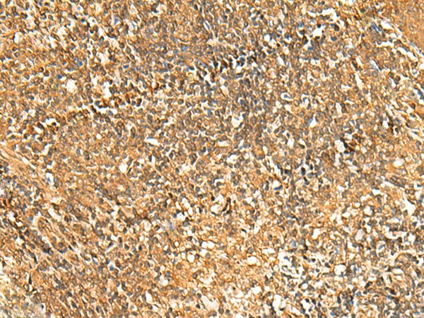 GSG1L Polyclonal Antibody (E-AB-52827)