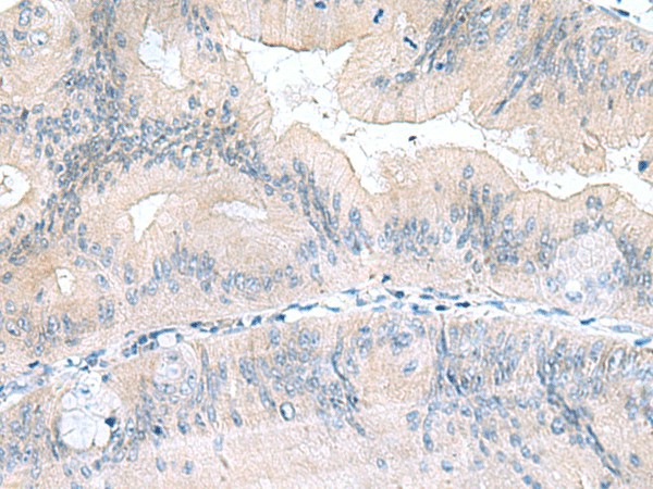 UBE2F Polyclonal Antibody (E-AB-19150)