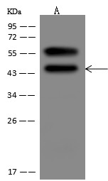 SerpinB3 Monoclonal Antibody (AN200226P)
