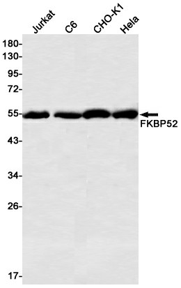 Recombinant FKBP52 Monoclonal Antibody (E-AB-81469)