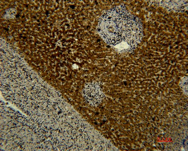 Transferrin Monoclonal Antibody (E-AB-22187)