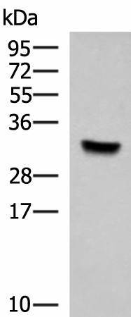 KCTD7 Polyclonal Antibody (E-AB-52089)