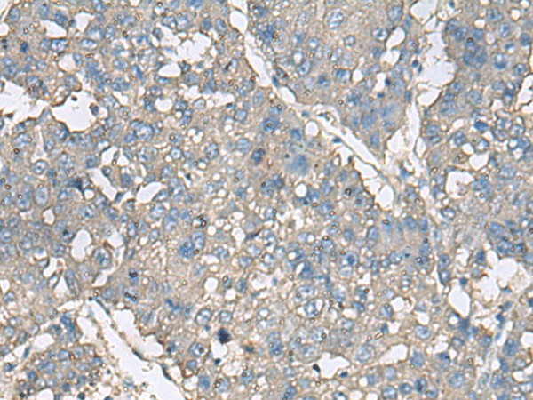 TNF Polyclonal Antibody (E-AB-52065)