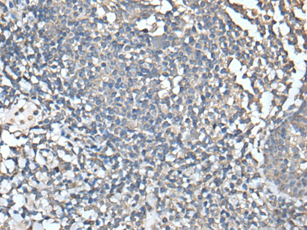 UBASH3A Polyclonal Antibody (E-AB-52430)