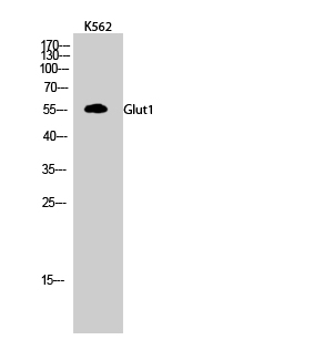 GLUT-1 Polyclonal Antibody (E-AB-31556)