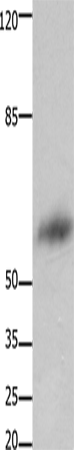 FOXJ3 Polyclonal Antibody (E-AB-15648)