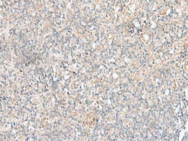 GSKIP Polyclonal Antibody (E-AB-18894)
