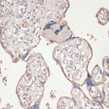 ASC / TMS1 Polyclonal Antibody (E-AB-66894)
