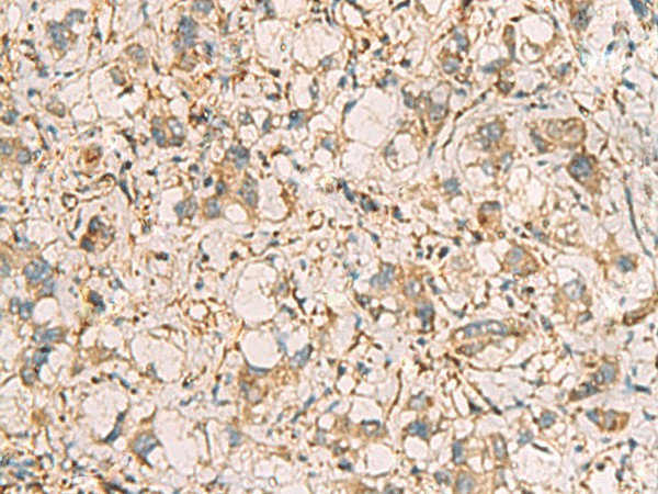 PRKRA Polyclonal Antibody (E-AB-19226)