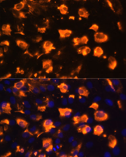 JAG2 Polyclonal Antibody (E-AB-66260)