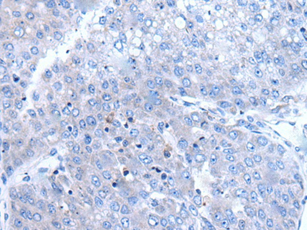 BTG4 Polyclonal Antibody (E-AB-52136)