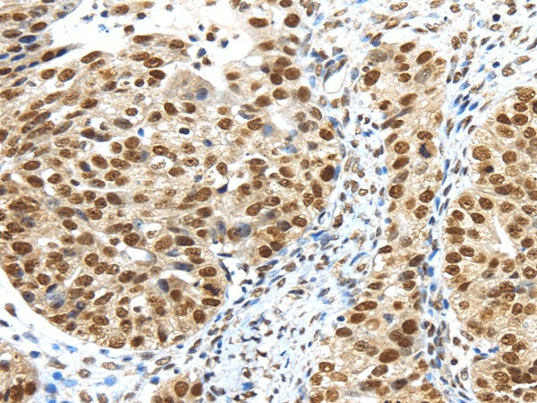 TRIM33 Polyclonal Antibody (E-AB-17457)