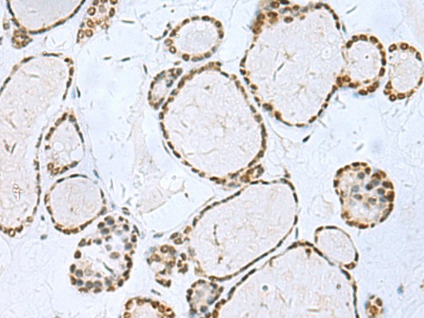 TH Polyclonal Antibody (E-AB-53276)