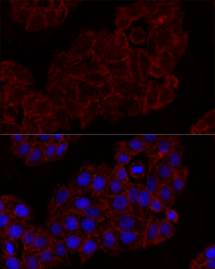 KLRK1 Polyclonal Antibody (E-AB-65850)