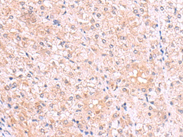 PISD Polyclonal Antibody (E-AB-52616)