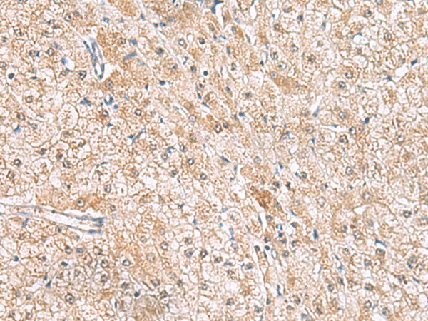HLA-E Polyclonal Antibody (E-AB-18997)