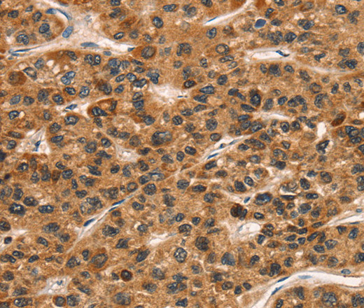 CD159a/c Polyclonal Antibody (E-AB-14248)