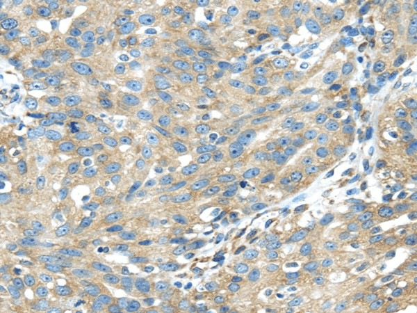 TXNDC5 Polyclonal Antibody (E-AB-17181)