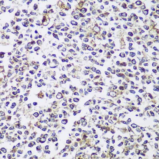 ECH1 Polyclonal Antibody (E-AB-64390)
