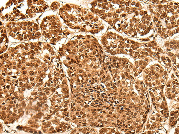 NEK7 Polyclonal Antibody (E-AB-53304)